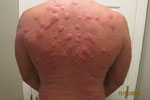 Safe Way to Eliminate Bed Bugs with Natural Bed Bug Formula Guaranteed Effective for Sarasota, FL